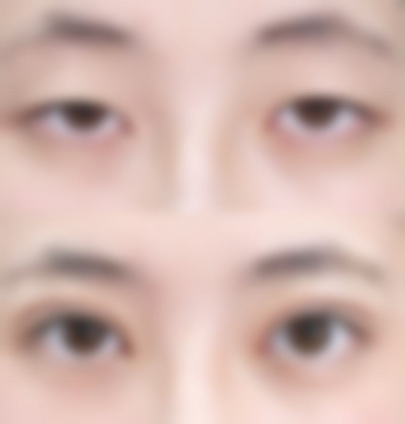 陈柳艺患者评价