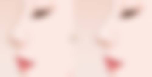 淮南凯婷美琪整形医院价格参考