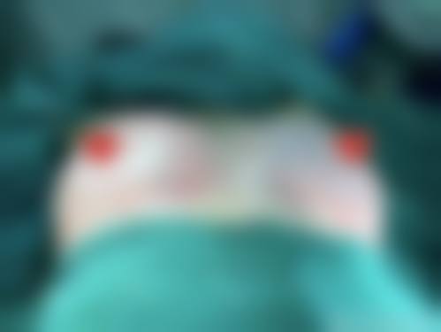 北京惜娜医疗美容诊所核心项目