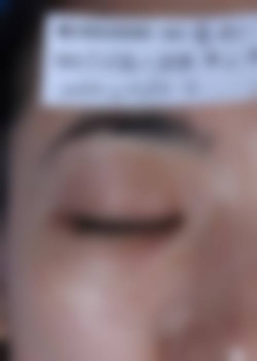 南京安欣（原蓓思丽）医疗美容门诊部患者评价