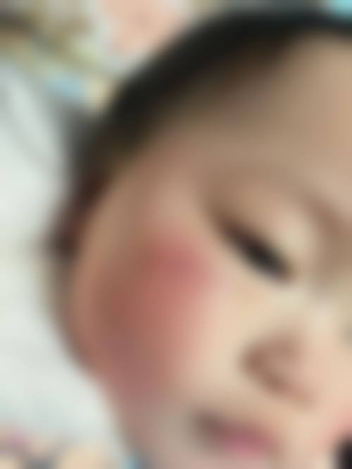 南京安欣（原蓓思丽）医疗美容门诊部价格参考