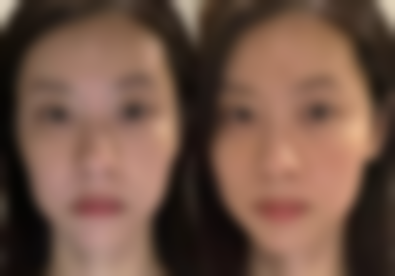 西安未央施尔绮医疗美容诊所价格参考