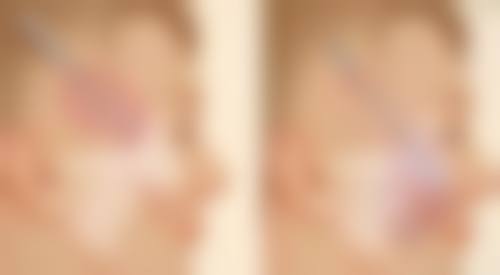 Metime星源美天医疗美容（万象城店）价格参考