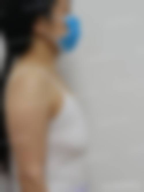 郑州美眼医疗美容中 心价格参考