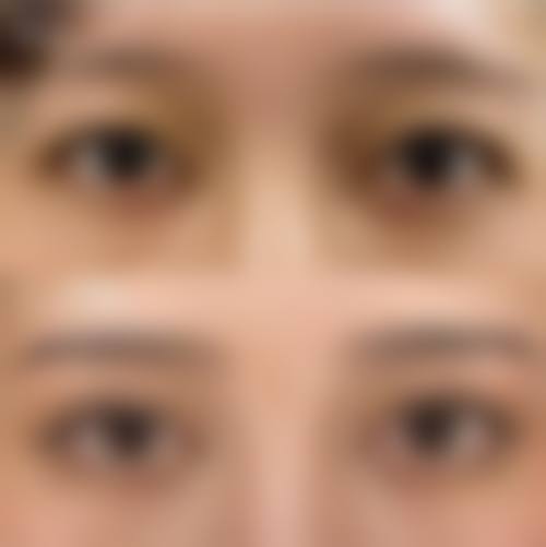 杭州友丽医疗美容诊所价格参考