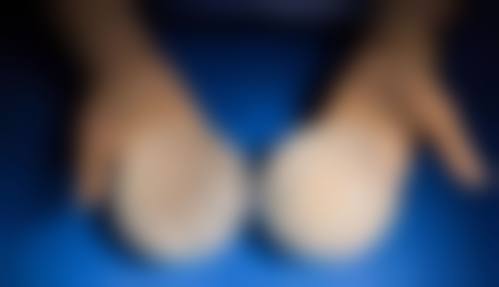 厦门张铭整形医院患者评价