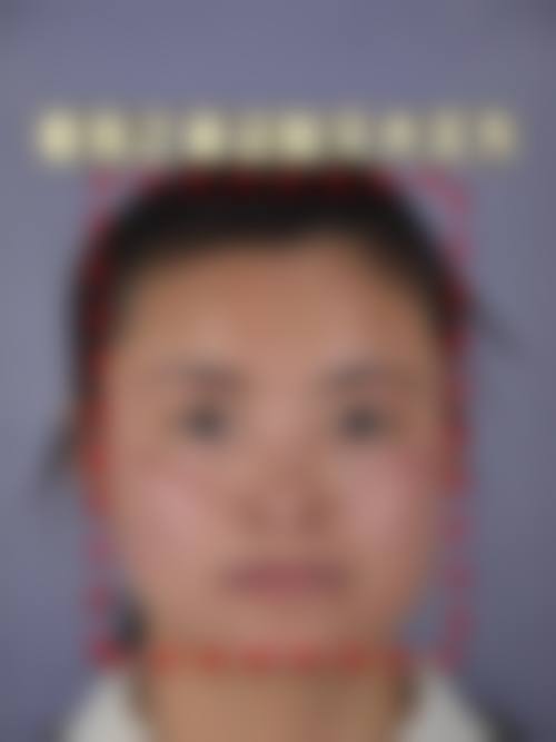 靖江三禾医疗整形美容医院患者评价