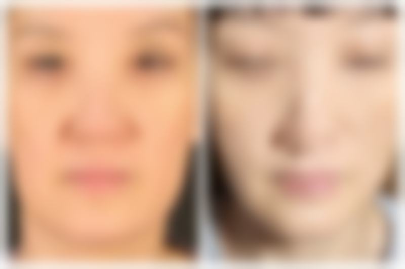 西安唯娜美颜医疗美容核心项目