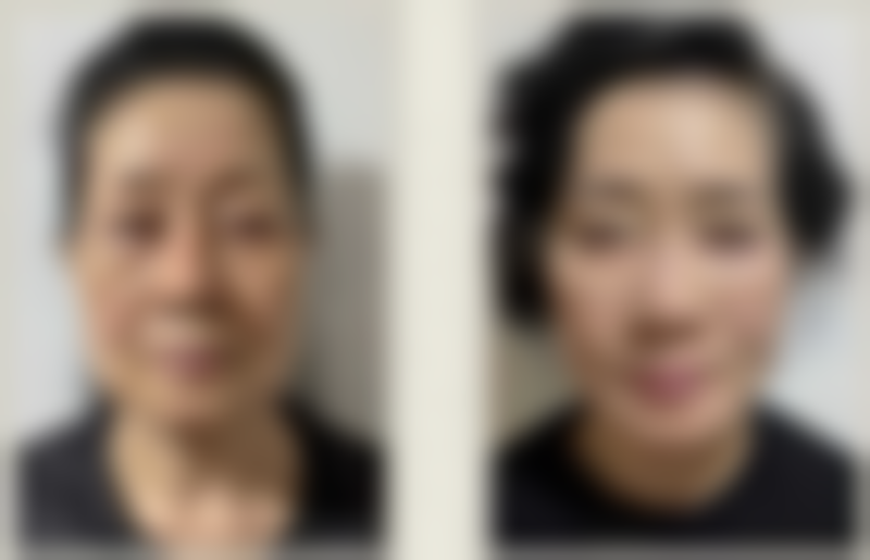 韩国清潭第一外科医生团队