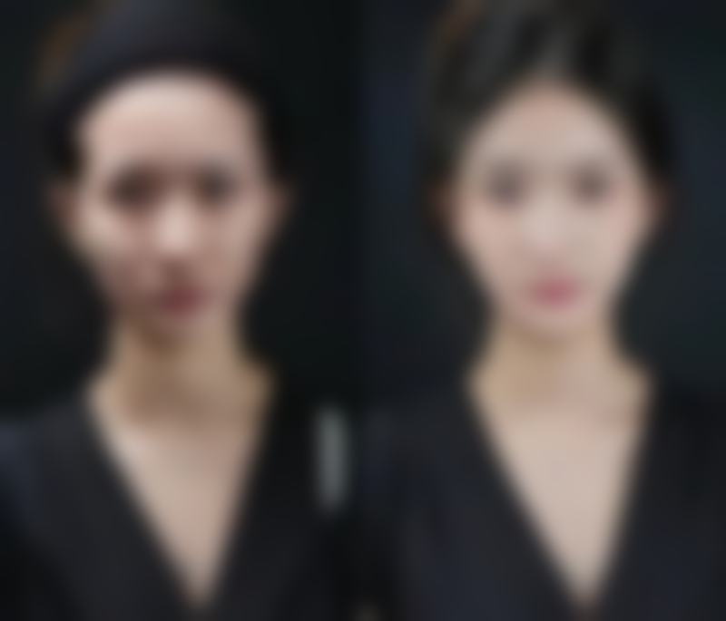 钱依琳患者评价