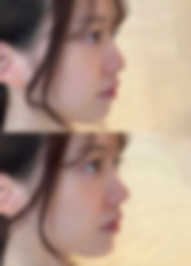 钱依琳预约方式