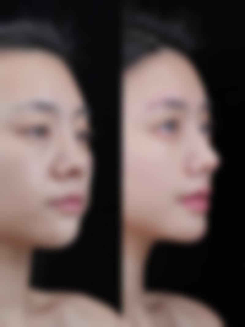 谢国华擅长项目列表