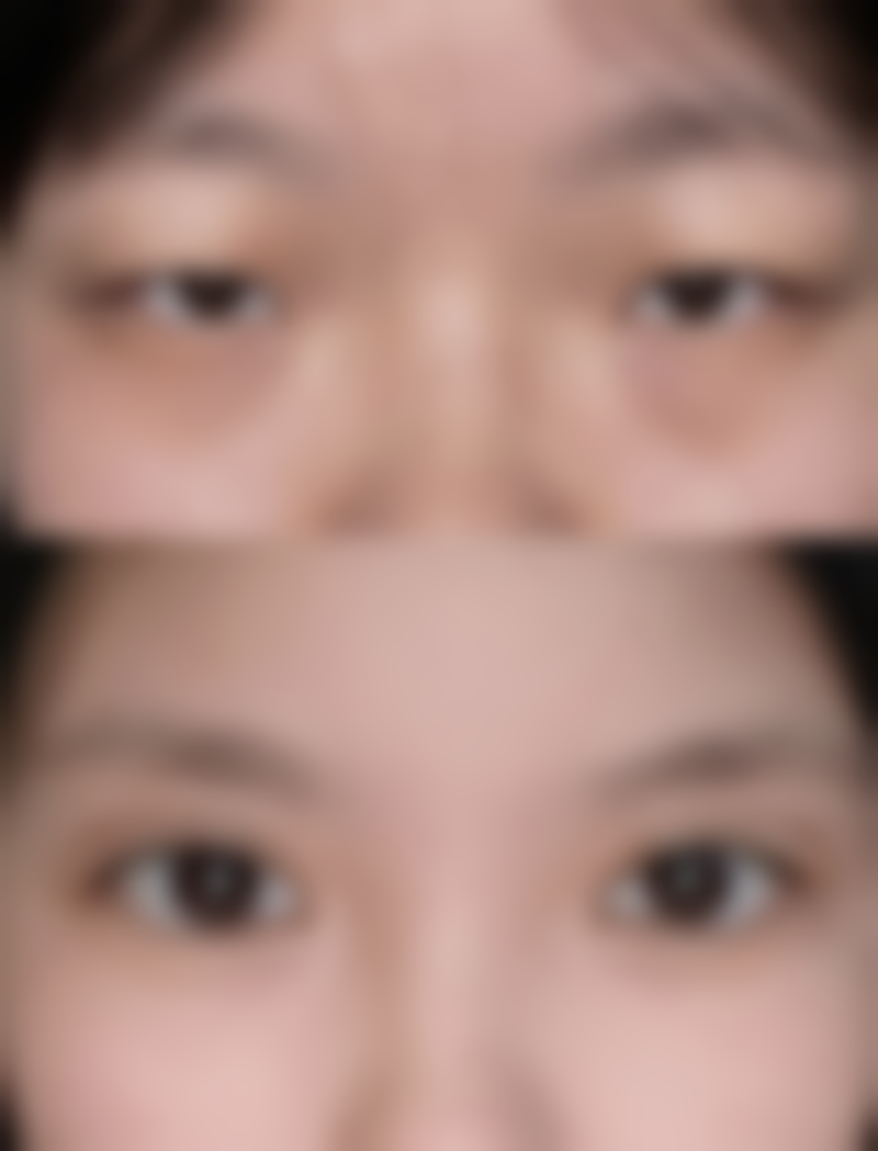 厦门同安潇洒整形医院价格参考