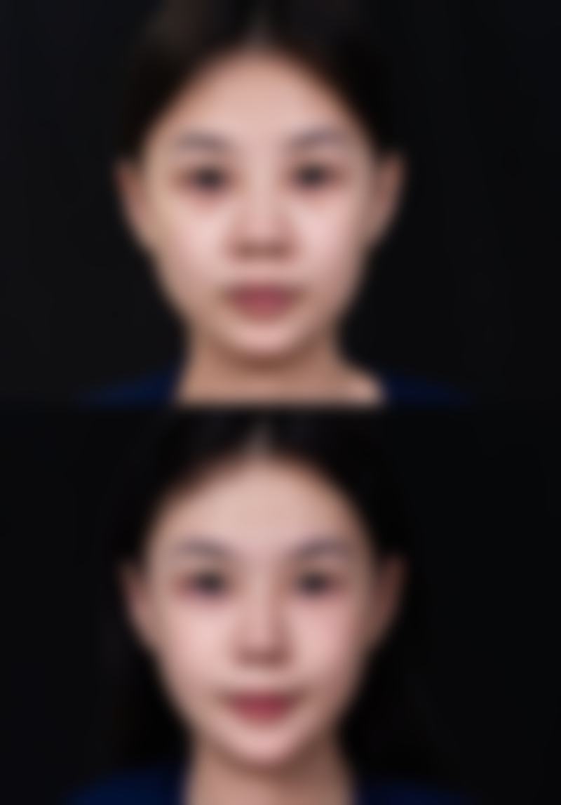 陈忱擅长项目列表