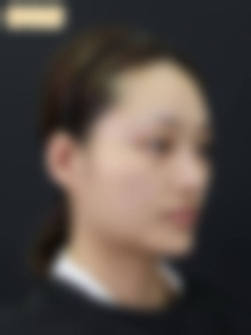 深圳美高壹美整形医院患者评价