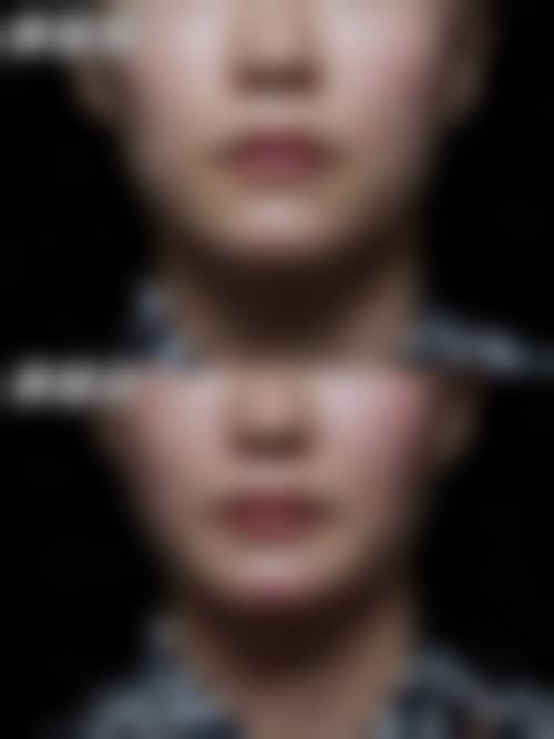 温州眼谷超级眼视光医院医疗美容科医生团队