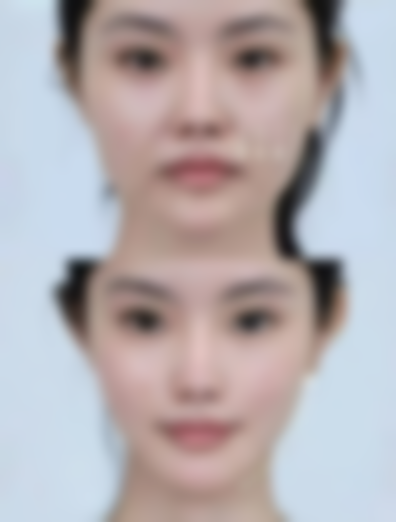 南昌丽莎美容医院价格参考