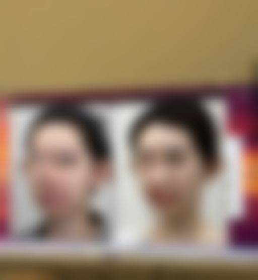 扬州艾菲斯整形医疗美容门诊部患者评价