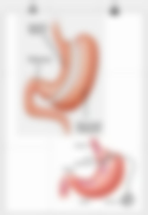 韩国首尔slim整形医院患者评价