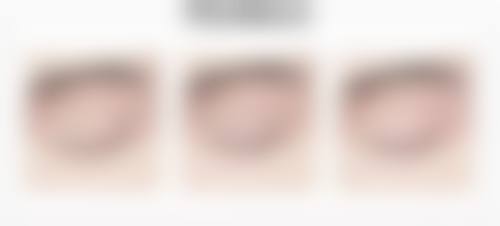 广州铂颜医疗美容门诊部价格参考