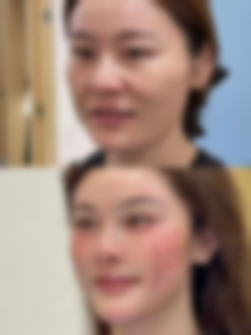 高碑店市燕赵大街惠美烧伤整形外科诊所价格参考