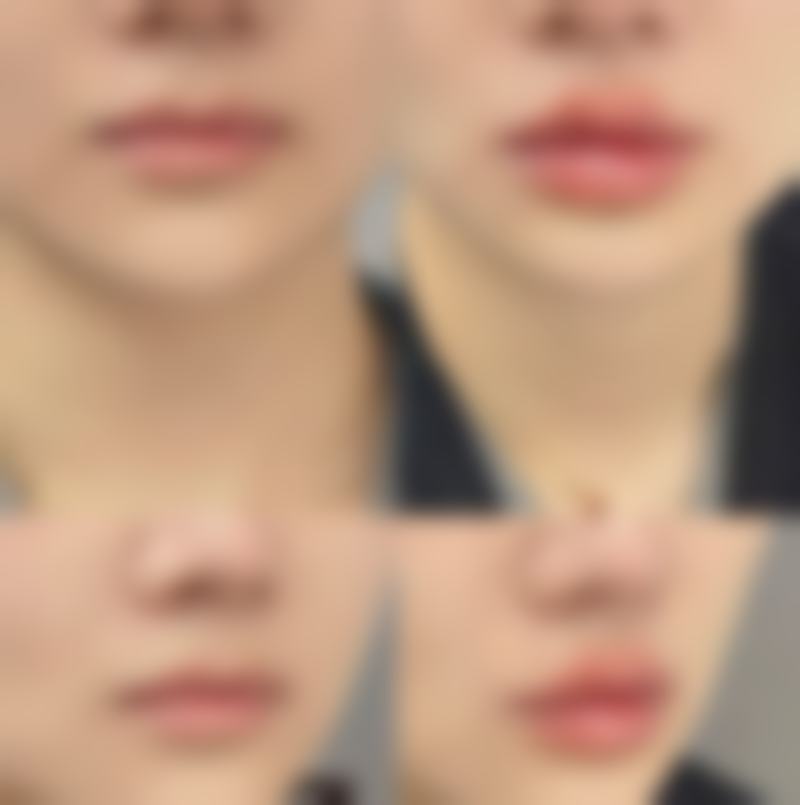 石家庄面容管家（汇美天成）医疗美容诊所正规资质