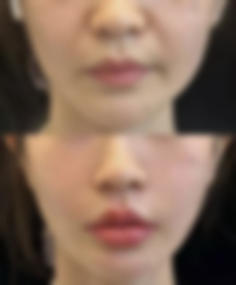 上海梵丽凯温医疗美容门诊部核心项目