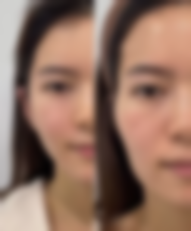 揭阳华美整形医院交通路线与预约