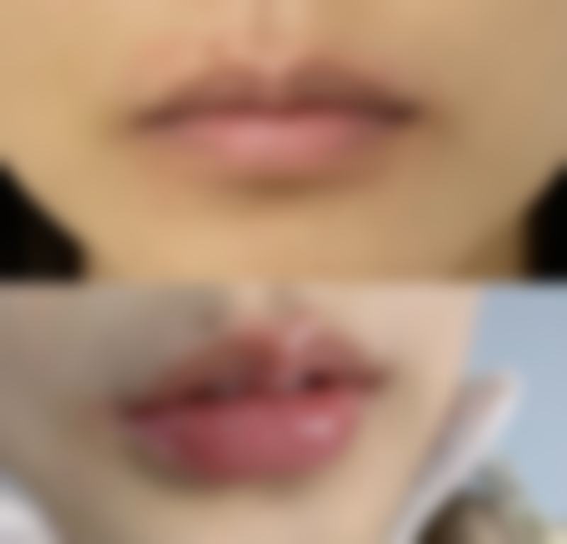 高碑店市燕赵大街惠美烧伤整形外科诊所患者评价