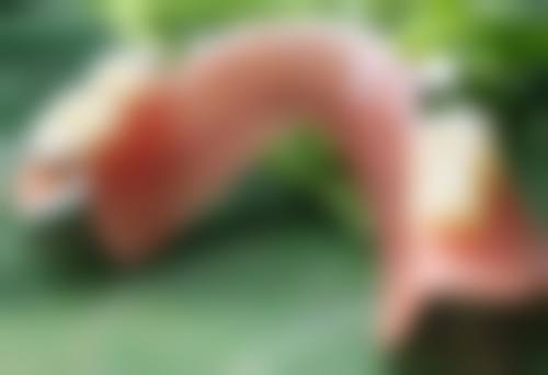 叶城新一美整形医院价格参考