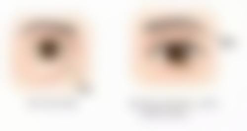 叶城新一美整形医院患者评价