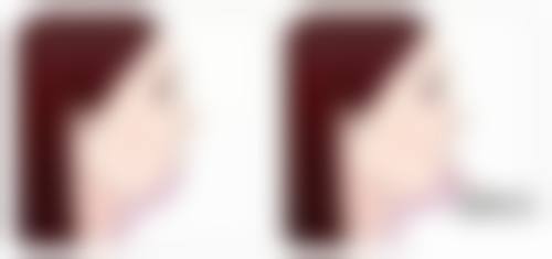 刘黎阳患者评价