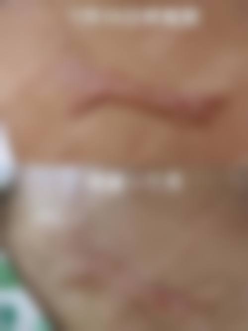 郑州黄河中 心医院医学整形美容科正规资质