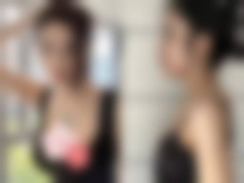 成都懿和丰德医学整形医院患者评价