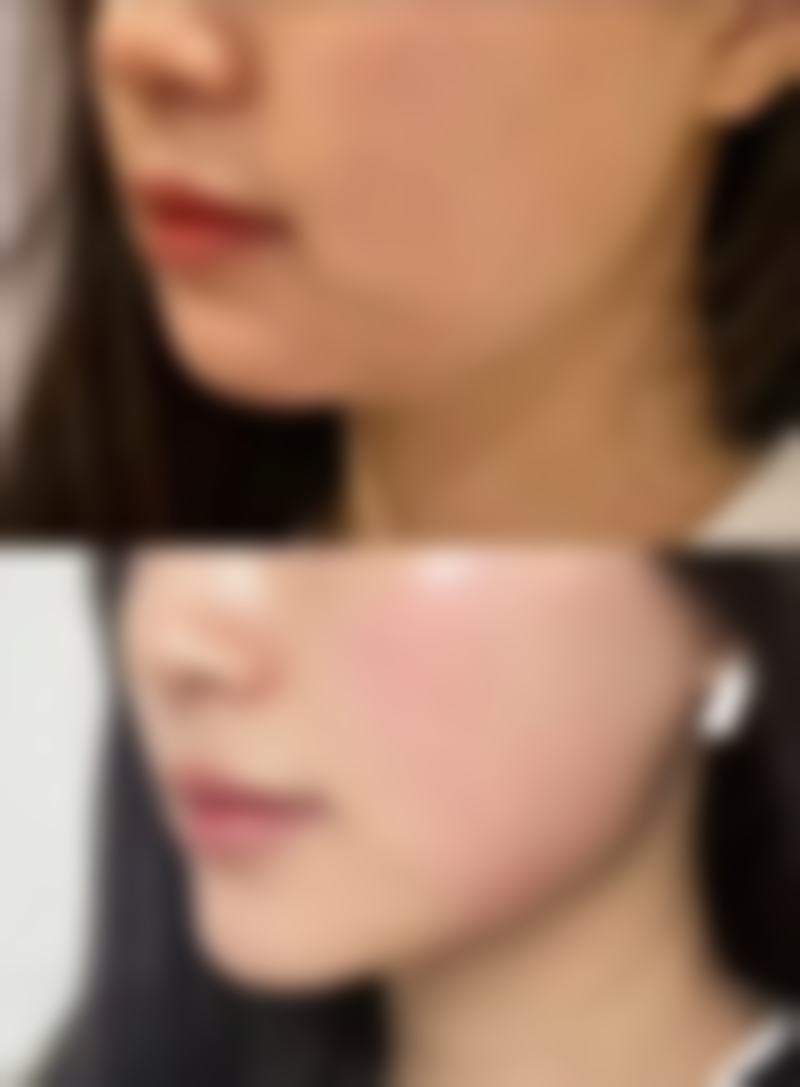 广州联成益美整形医院核心项目