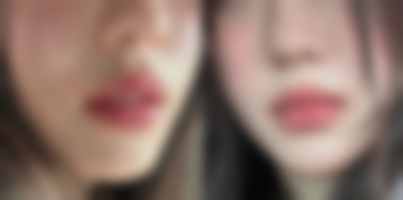 玉山县可丽整形医院交通路线与预约