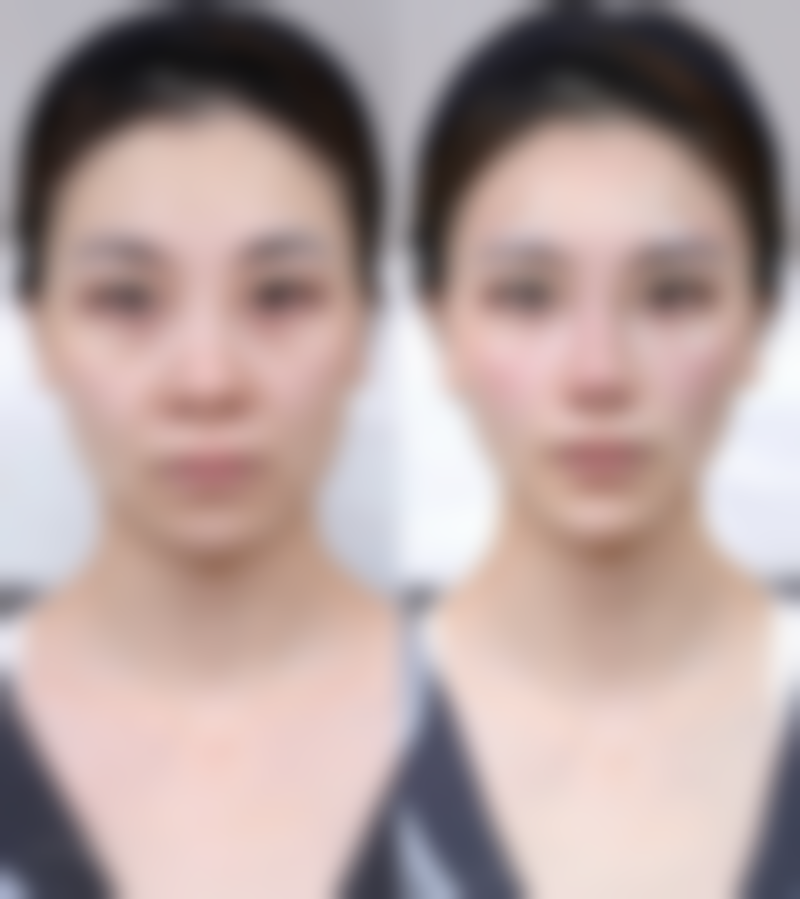 刘黎阳擅长项目列表