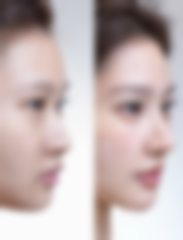 玉山县可丽整形医院核心项目