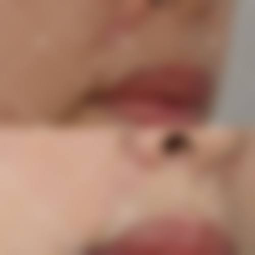 山东大学第二医院美容整形烧伤外科核心项目