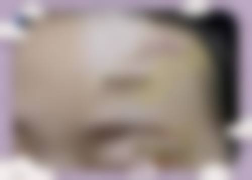 山东大学第二医院美容整形烧伤外科患者评价