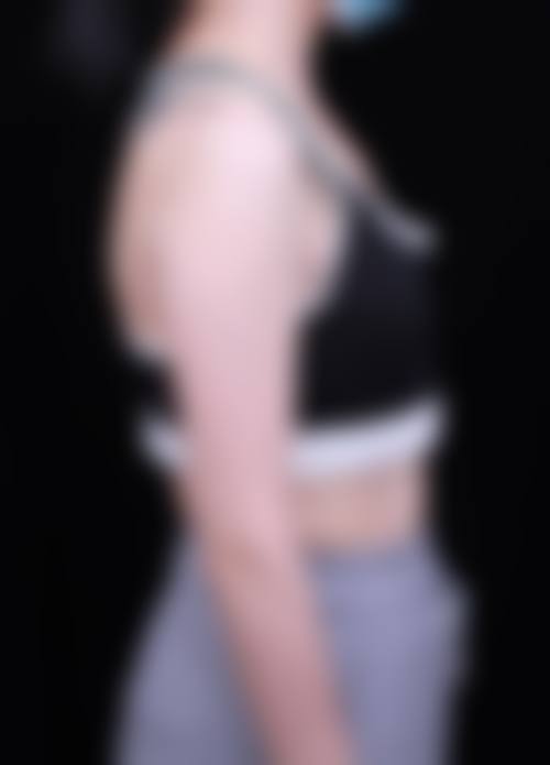 湖北武汉千喜百艺整形医院价格参考