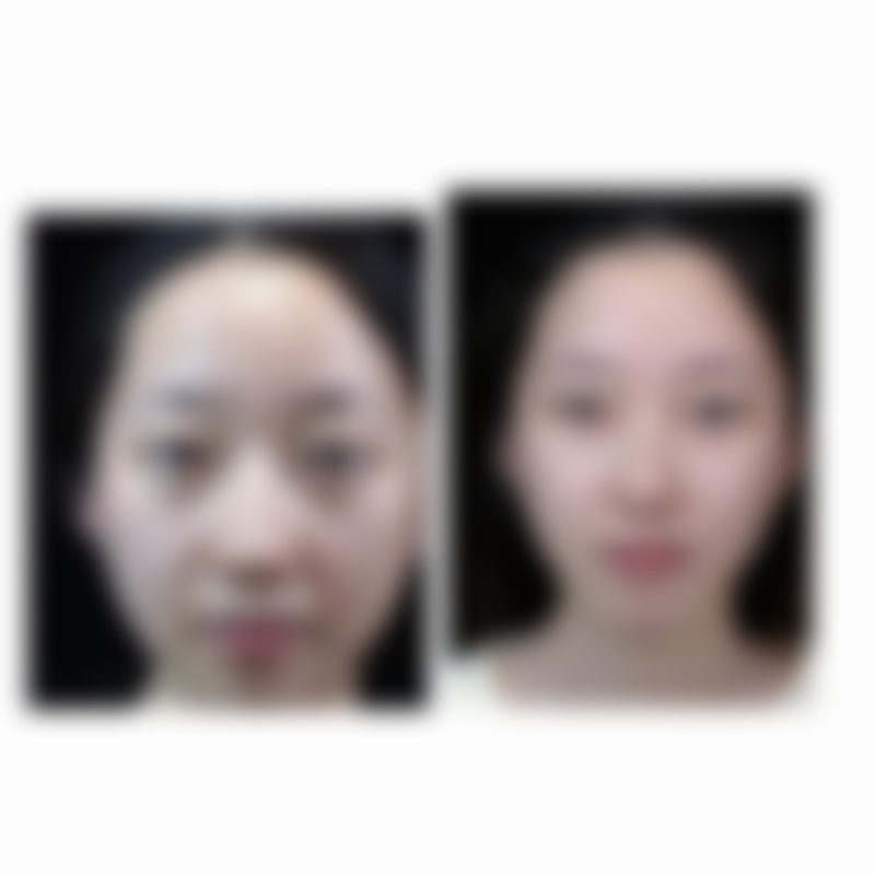 狎鸥亭W整形外科价格参考