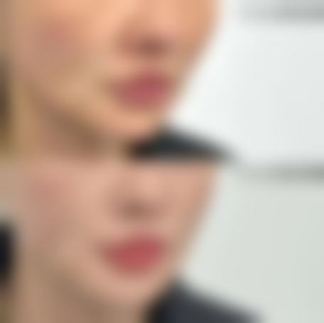 东营胜利油田中 心医院整形美容科价格参考