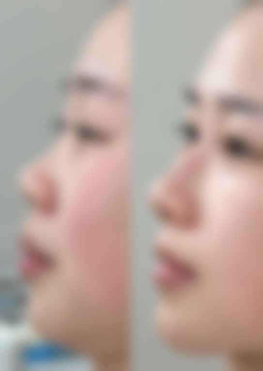 刘黎阳擅长项目列表