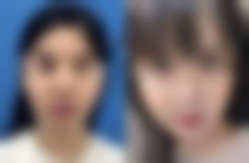 江阴兰积整形医院价格参考