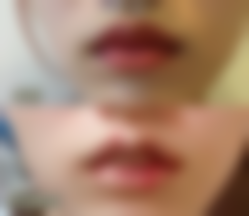 优妩彩医院价格参考