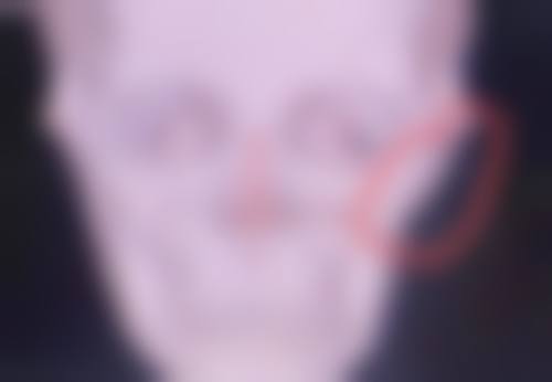 韩国美佳整形美容医院价格参考