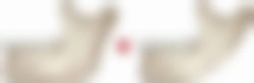 韩国美佳整形美容医院患者评价