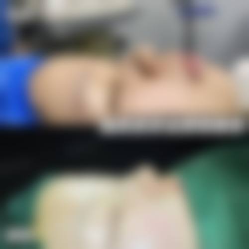 刁良亚患者评价