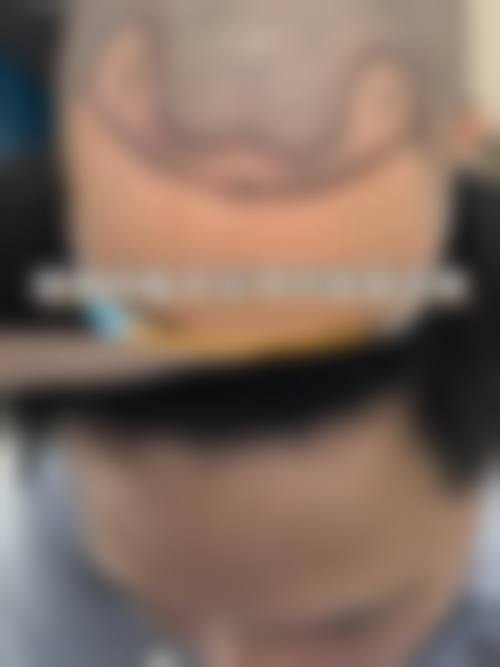 何展宏擅长项目列表